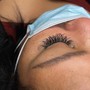 Eyelash Removal