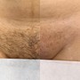 New Client Brazilian Sugaring