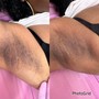 Brazilian, Underarm + Eyebrow Wax