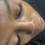 Nano Infusion Facial