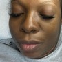 Eyelash Extension Removal