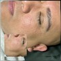 Lux Dermaplane Facial