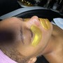 Back Facial with Microdermabrasion