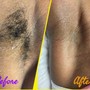 Underarm Wax