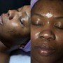 Oxygen Facial