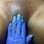 Men’s Brazilian Wax