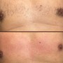 Men’s Brazilian Wax