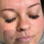 Eyelash Extension Removal