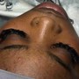 Eyelash Extension Removal