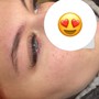 Microdermabrasion facial