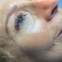 Dermaplaning facial