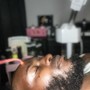 Dermaplaning