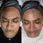 Infusion Facial