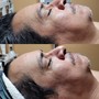 Infusion Facial