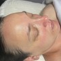 Dermaplaning facial