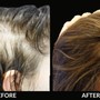 Hair Restoration/Hair Loss Treatment