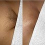 Men’s Brazilian Wax