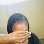 Scalp Treatment