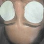 Facial