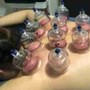 30 Min Cupping Therapy