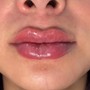 Lips