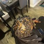 Scalp Treatment