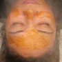 Radiance Renewal Microdermabrasion