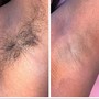 Men’s Brazilian Wax