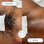 Basic Underarm facial