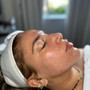 Neveskin Facial (CRYO FACIAL)