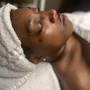 Acne Facial