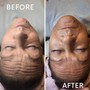 Facelift Facial