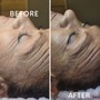 Beauty Glow Treatment