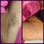 Underarm Wax