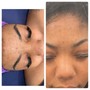 Dermaplaning Facial