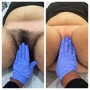 Vajacial, Brazilian Wax