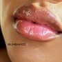 1ml MicroNeedle Lip Filler