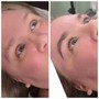 Eyelash Extension Removal