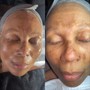 Shilah’s Rejuvenation Facial