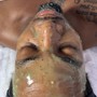 Oxygen Facial