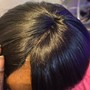 Scalp Treatment