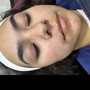 Facial