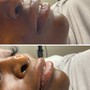 Eyelash Extension Removal