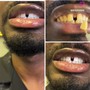 24k gold 40 MINUTES TEETH WHITENING