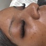 Eyelash Extension Removal