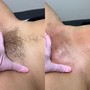 Brazilian Sugaring