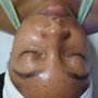 Oxygen Facial