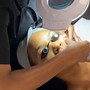 Brightening Chemical Peel