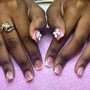 Nail repair