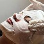 Microdermabrasion